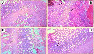<mark class="highlighted">Butin</mark> Attenuates Arthritis in Complete Freund’s Adjuvant-Treated Arthritic Rats: Possibly Mediated by Its Antioxidant and Anti-Inflammatory Actions